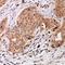 Bone Morphogenetic Protein 4 antibody, LS-C667714, Lifespan Biosciences, Immunohistochemistry paraffin image 