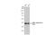 DNA Polymerase Beta antibody, GTX02848, GeneTex, Western Blot image 