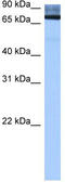 Adenosine Deaminase Domain Containing 2 antibody, TA343988, Origene, Western Blot image 