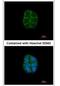 Desmoglein 2 antibody, NBP1-33374, Novus Biologicals, Immunofluorescence image 