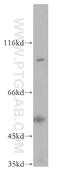 Tousled Like Kinase 1 antibody, 13564-1-AP, Proteintech Group, Western Blot image 