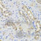 DISC1 Scaffold Protein antibody, A2898, ABclonal Technology, Immunohistochemistry paraffin image 