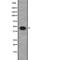 G Protein Subunit Alpha 12 antibody, abx215489, Abbexa, Western Blot image 