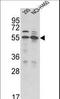 Transmembrane protease serine 2 antibody, LS-C100563, Lifespan Biosciences, Western Blot image 