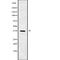 Calponin 3 antibody, abx149431, Abbexa, Western Blot image 