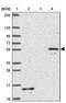 T-Box 15 antibody, NBP2-49036, Novus Biologicals, Western Blot image 