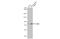 Coilin antibody, GTX112570, GeneTex, Western Blot image 