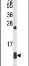 Hemoglobin Subunit Alpha 2 antibody, PA5-26421, Invitrogen Antibodies, Western Blot image 