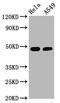 GATA Binding Protein 3 antibody, CSB-RA009276A308phHU, Cusabio, Western Blot image 