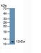 Diazepam Binding Inhibitor, Acyl-CoA Binding Protein antibody, LS-C302454, Lifespan Biosciences, Western Blot image 