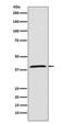 MCL1 Apoptosis Regulator, BCL2 Family Member antibody, M00712, Boster Biological Technology, Western Blot image 