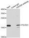 RNA Polymerase II Subunit H antibody, LS-C748392, Lifespan Biosciences, Immunoprecipitation image 