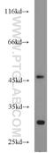 Pyruvate Dehydrogenase Kinase 3 antibody, 12215-1-AP, Proteintech Group, Western Blot image 