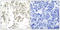 Checkpoint Kinase 1 antibody, LS-C117319, Lifespan Biosciences, Immunohistochemistry frozen image 