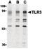 Toll Like Receptor 3 antibody, LS-B687, Lifespan Biosciences, Western Blot image 