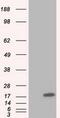 Tetratricopeptide Repeat Domain 32 antibody, GTX83482, GeneTex, Western Blot image 