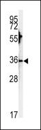 Carbonic Anhydrase 3 antibody, LS-B9781, Lifespan Biosciences, Western Blot image 