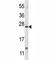 X-Box Binding Protein 1 antibody, F42468-0.4ML, NSJ Bioreagents, Western Blot image 