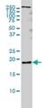 Pleiotrophin antibody, H00005764-M01, Novus Biologicals, Western Blot image 