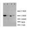 Insulin Like Growth Factor 1 Receptor antibody, LS-C313491, Lifespan Biosciences, Western Blot image 