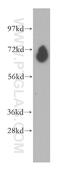 Phosphodiesterase 1C antibody, 13785-1-AP, Proteintech Group, Western Blot image 