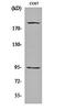 Insulin Like Growth Factor 1 Receptor antibody, orb159544, Biorbyt, Western Blot image 