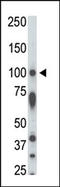Serine/Threonine Kinase 31 antibody, AP13932PU-N, Origene, Western Blot image 