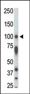 Serine/Threonine Kinase 31 antibody, AP13932PU-N, Origene, Western Blot image 