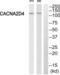 Calcium Voltage-Gated Channel Auxiliary Subunit Alpha2delta 4 antibody, abx015002, Abbexa, Western Blot image 