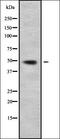 Cleavage And Polyadenylation Factor I Subunit 1 antibody, orb338570, Biorbyt, Western Blot image 