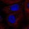 Coiled-Coil Domain Containing 93 antibody, NBP2-30369, Novus Biologicals, Immunofluorescence image 