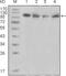 Protein Tyrosine Kinase 2 Beta antibody, MA5-15407, Invitrogen Antibodies, Western Blot image 