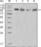 Protein Tyrosine Kinase 2 Beta antibody, MA5-15407, Invitrogen Antibodies, Western Blot image 