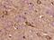 KiSS-1 Metastasis Suppressor antibody, GTX37642, GeneTex, Immunohistochemistry paraffin image 