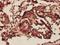 Prohibitin antibody, H00005245-M01, Novus Biologicals, Immunohistochemistry paraffin image 