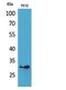 Major Histocompatibility Complex, Class II, DQ Beta 1 antibody, STJ96857, St John