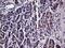 Hyaluronan Binding Protein 2 antibody, MA5-27128, Invitrogen Antibodies, Immunohistochemistry paraffin image 