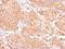 Zinc Finger Protein 134 antibody, GTX102844, GeneTex, Immunohistochemistry paraffin image 