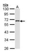 CDP-Diacylglycerol Synthase 1 antibody, NBP1-33434, Novus Biologicals, Western Blot image 