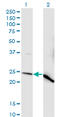 NADH:Ubiquinone Oxidoreductase Core Subunit V2 antibody, LS-C197762, Lifespan Biosciences, Western Blot image 