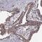 ABL Proto-Oncogene 2, Non-Receptor Tyrosine Kinase antibody, NBP2-68946, Novus Biologicals, Immunohistochemistry paraffin image 