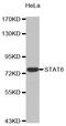 Signal Transducer And Activator Of Transcription 6 antibody, STJ25724, St John