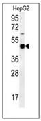 Pyruvate Dehydrogenase E1 Alpha 1 Subunit antibody, AP53240PU-N, Origene, Western Blot image 