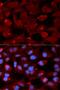 SWI/SNF Related, Matrix Associated, Actin Dependent Regulator Of Chromatin, Subfamily B, Member 1 antibody, LS-B12907, Lifespan Biosciences, Immunofluorescence image 