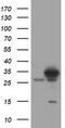 SRP Receptor Subunit Beta antibody, TA504724, Origene, Western Blot image 