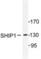 Inositol Polyphosphate-5-Phosphatase D antibody, LS-C176469, Lifespan Biosciences, Western Blot image 