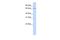 Kelch Like Family Member 26 antibody, PA5-41592, Invitrogen Antibodies, Western Blot image 