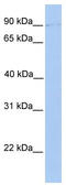 Protein O-Mannosyltransferase 2 antibody, TA341917, Origene, Western Blot image 