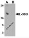 Interleukin 36 Beta antibody, 7507, ProSci, Western Blot image 