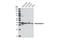 Tropomyosin alpha-1 chain antibody, 3910S, Cell Signaling Technology, Western Blot image 